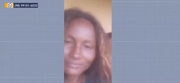 Mulher tem 90% do corpo queimado e marido é preso como principal suspeito no MA