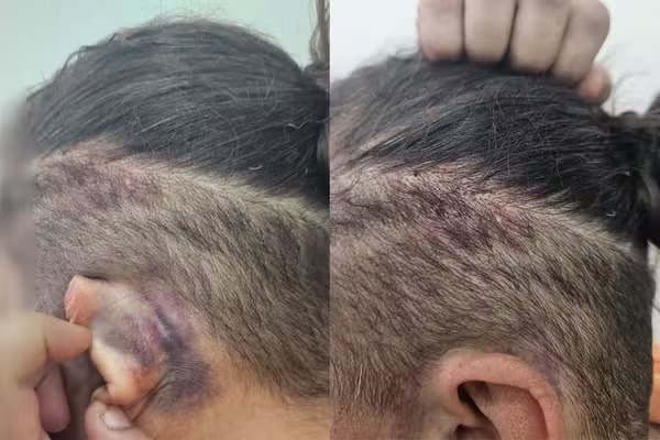 Suspeitos de sequestrar e torturar mulher por desaparecimento de homem são presos em Teresina