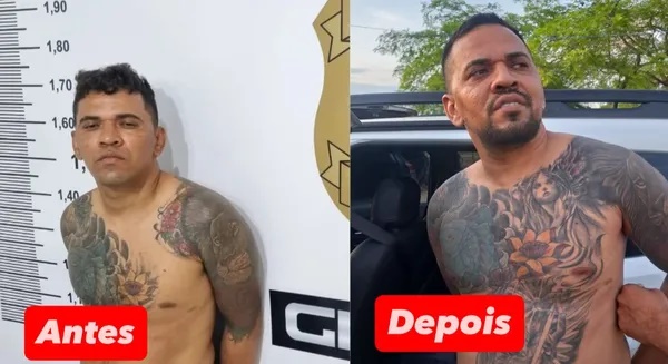 Veja antes e depois de chefe de facção procurado em 3 estados; ia a clínicas para mudar rosto, segundo a Polícia