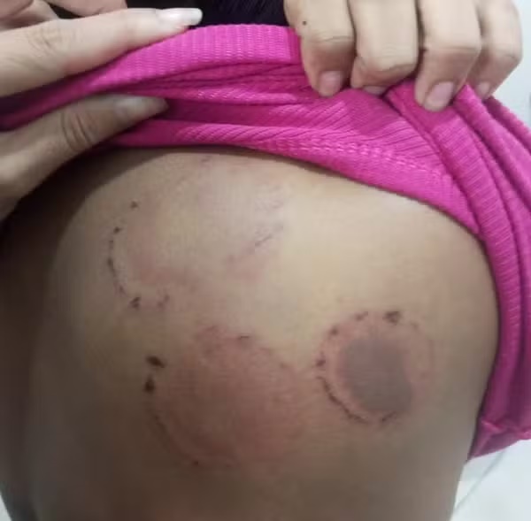 Homem é preso em flagrante após agredir a namorada com socos e mordidas em Pinheiro