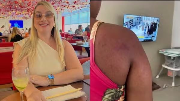 OAB pede prisão de patroa que agrediu doméstica grávida no MA; entidade classificou crime como tortura
